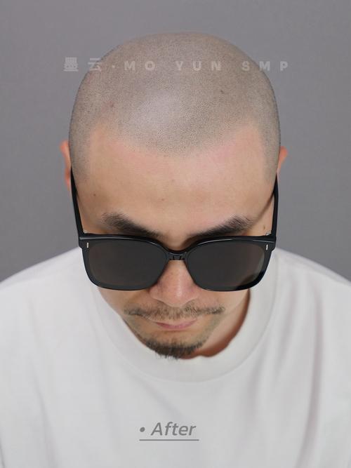 姆伯莫：为什么剃光头？之前有发型师理错了发型，索性全剃了